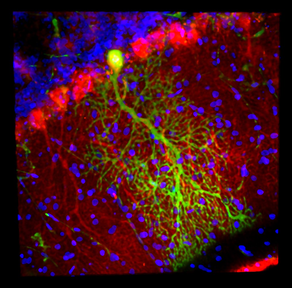 The 3D laser-scanning confocal image depicts a cerebellar Purkinje neuron (green) that has fused with a green fluorescently labelled bone marrow cell.